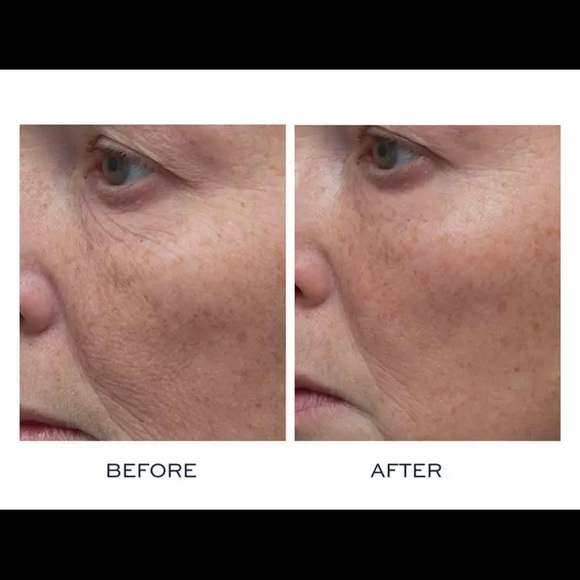 Elemis Peptide4 Thousand Flower Mask 75ML - Picture 4 of 5